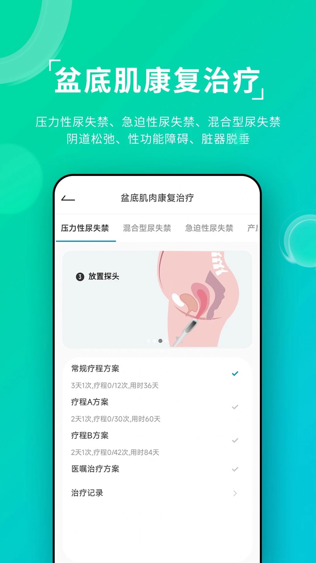 云天开盆底健康助手app图片1